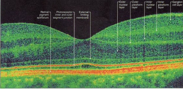LectSet 1- Light propagation - spatial-ss1_52.gif